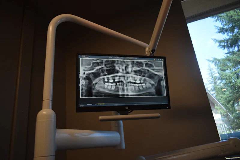 A dental X-ray of a full set of teeth on a clinic screen